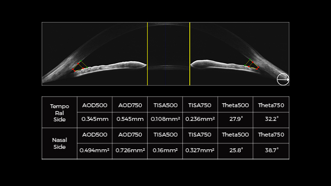 16mm angle-to-angle analysis