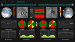 High scanning speed at 80,000 A-scans/s