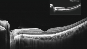 16mm angle-to-angle analysis