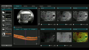 Comprehensive GLAUCOMA analysis